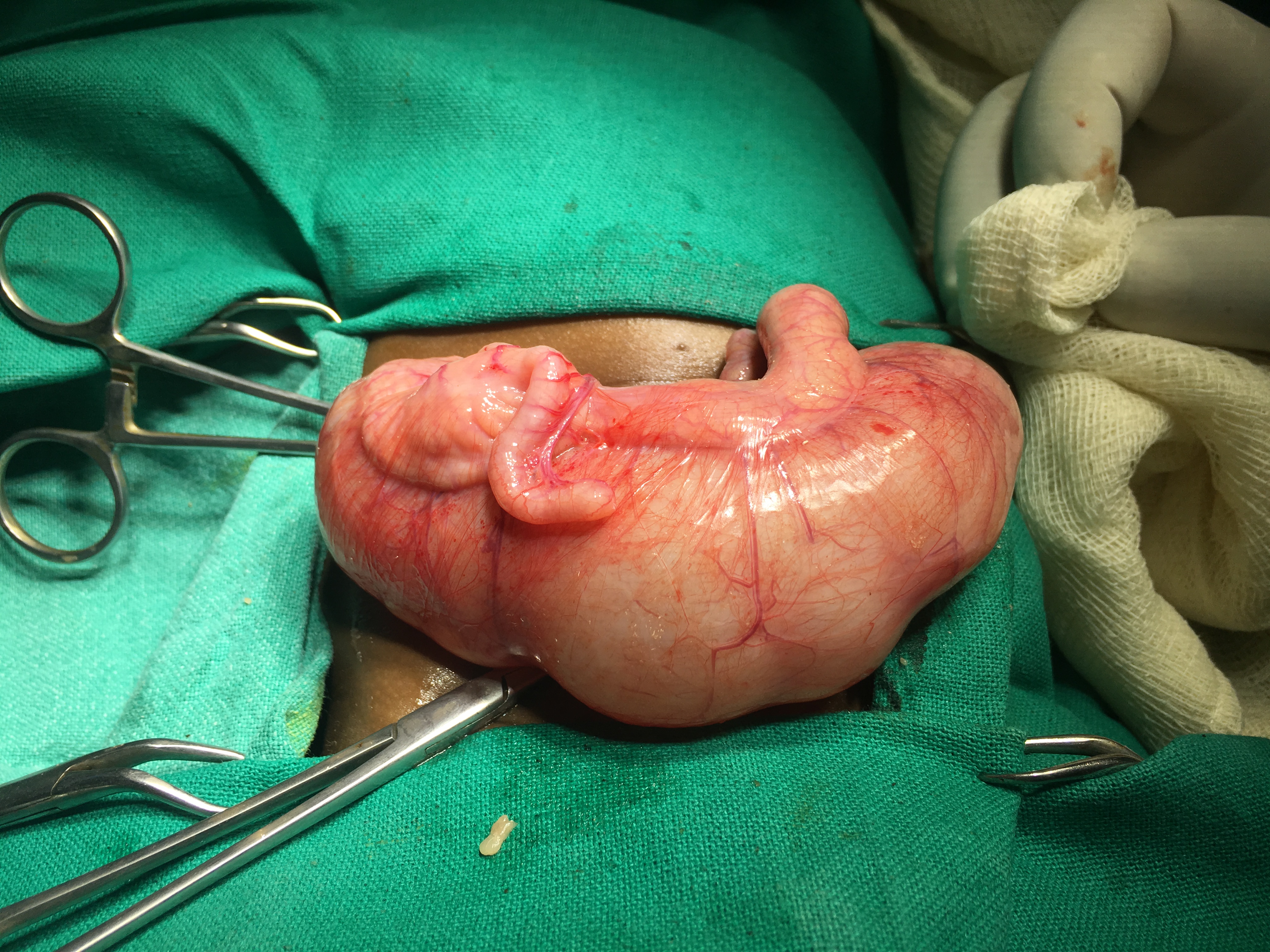 Pediatric G.I. Surgery Image 7